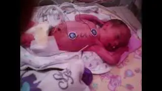 Our preemies Alexis And Maci :)