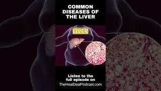Common diseases of the liver | The Heal Deal Podcast with Dr. Leona - Episode 22