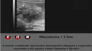 video05