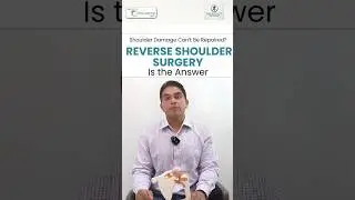 Advanced Reverse Shoulder Replacement Surgery in Ludhiana for Pain Relief  | Orthoderma Clinic
