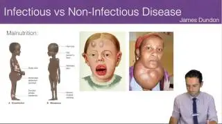 Infectious vs Non-Infectious Disease
