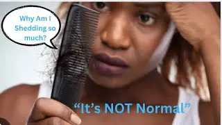 “If Your Hair Keeps Shedding, Watch This Before Trying Another Style”