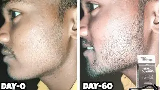 Man matters beard gummies review after use 2 months | man matters beard gummies review |beard growth