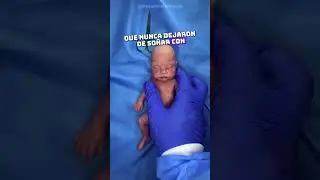 No podr&aacute;s dejar de mirar a este beb&eacute; reci&eacute;n nacido&hellip; 😳