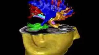 Brain Fiber Tractography
