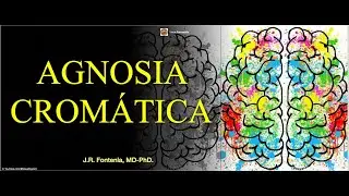 Agnosia Cromática. / Agnosia del Color. / Agnosia Visual.