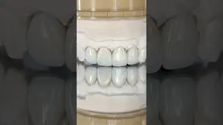 Signature Amber Press Crowns and Veneers #lsk121shorts #dentist #teethsmile