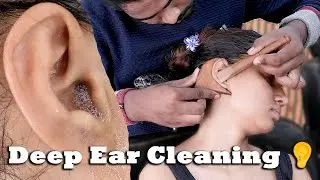 Beautiful Girl Gets Deep Ear Cleaning 👂 | ASMR Therapy