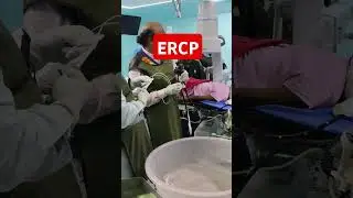ERCP #Endoscopy #ICU #viral #shortvideo