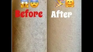 HOW TO GET RID OF OLD SCARS FAST