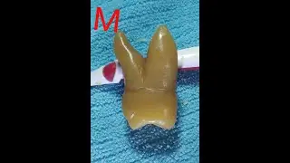 Tallado en Jabón Primer molar superior izquirdo Pieza 26 Parte 2
