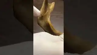 Human Mandible Complete Spotting | Bone Anatomy | OSPE | VIVA | Rawalpindi Medical University