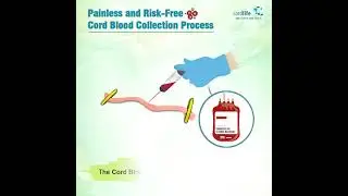 Cord Blood Collection Process - CordlifeIndia