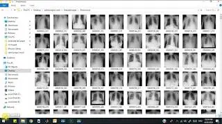 Detection of Covid-19 From Chest X-ray Images (MATLAB Projects) Part - 1