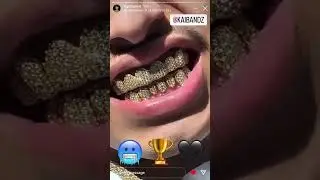 Fresno Bulldog Rapper FAY3HUNNIT Shows his vvs Diamond grills #559 #fresno #rap