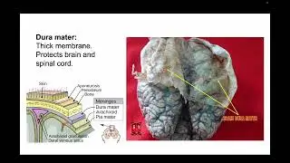 Lab 6 Comparative Anatomy Nervous and Visual Systems
