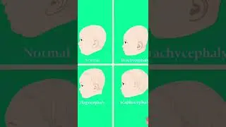 5 tips to prevent flat head in babies       round head shape tips
