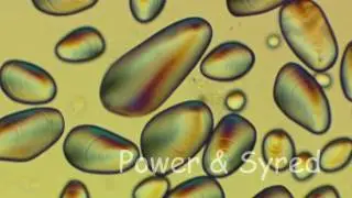 Potato starch