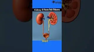 Urine formation in kidney animation | How urine forms in kidney#Stones