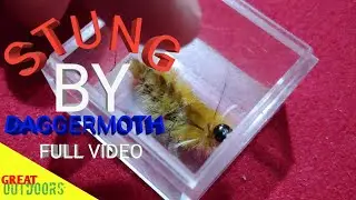 Stung By The Dagger Moth Catterpilar, ouch Full Video