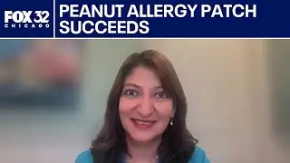 Peanut allergy patch succeeds in late-stage study | ChicagoLIVE