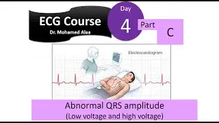 ECG course; Day (4); Part (C): Abnormal QRS amplitude (low voltage and high voltage)