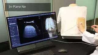 Ultrasound interventions on the U/S Mentor