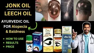 LEECH OIL | JONK OIL | FOR ALOPECIA | JONK KA TEL | HOW TO USE | REVIEW & RESULTS | ESSENTIAL OIL