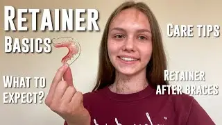 RETAINER BASICS 101/all you need to know about retainers(care tips, what to expect, Hawley retainer)