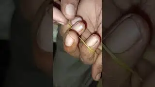 1rubber trick video shorts #youtube #vayral #short