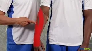Vendaje kinesiol&oacute;gico para el codo de tenista | Actimove