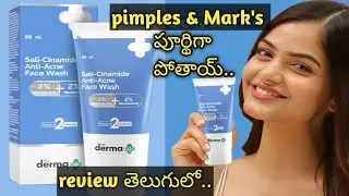 Derma co sali cinamide Anti Acne face wash review in Telugu #Derma products #beautyproductreview