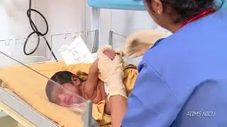 How to do micro ESR?