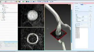 SimVascular Tutorial 3:  2D Segmentations with Level Set and Manual