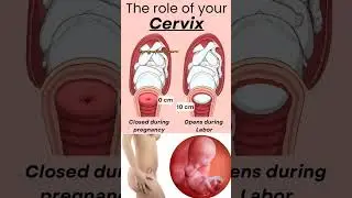 The Role of Cervix in Pregnancy and Birth #baby  #LaborAndDelivery #BirthProcess #PregnancyCare 🥰🙏