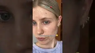 Korean skincare is a Scam- Here&rsquo;s why!