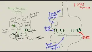 Depression & antidepressants, serotonin, stress, glutamate theories, Kirsch, Whitaker, Grace Jackson