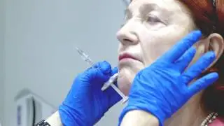 Филлеротерапия в клинике д-ра Вернер