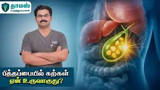 பித்தப்பையில் கற்கள் | காரணங்களும்? தீர்வும்? Gall Bladder Stone  Symptoms & Treatment