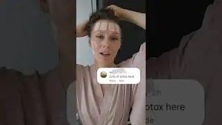 49 and Botox Free