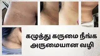 Tips to remove black neck pigmentation easily