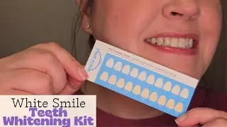 White Smile Teeth Whitening Kit | Before & After Results | Product Overview