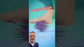 Doctor Reacts! Don&rsquo;t step on THESE!!!
