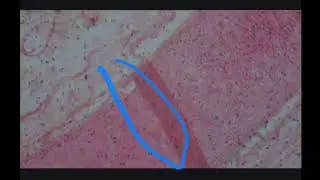 Easy way to identify the type of cartilage under microscope in 2 minutes #anatomystudies #anatomytip