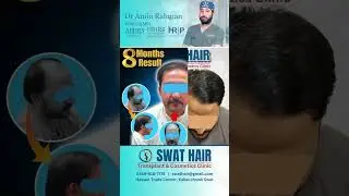 Amazing Results