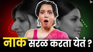 Facelift | Plastic Surgery | Nose Correction Surgery | Rhinoplasty Surgery | Urmila Nimbalkar