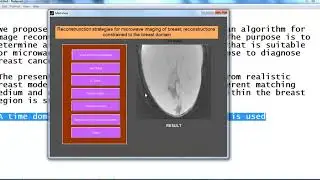 matlab projects on image processing with source code