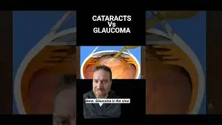Cataracts Vs Glaucoma (What Is The Difference?)