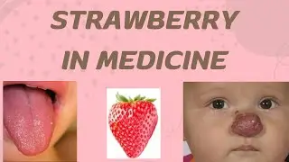 Strawberry in Medicine |Strawberry Tongue |Strawberry Gingiva|Strawberry Gum #medicalnotes #neetmds
