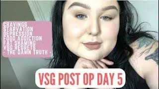 VSG REGRETS - WHAT THEY DON&rsquo;T TELL YOU - PAIN